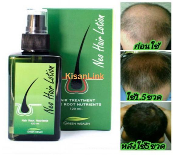 Neo Hair Lotion Price in Tando Allahyar | 03008786895 | Order Now At BWPakistan.com